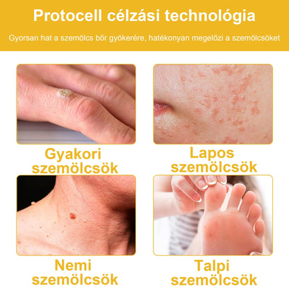 🐝💖BSWELL® Méhméreg Kezelés Krém👨‍⚕️（AAD ajánlott） (🔥utolsó nap promóció 80% ki